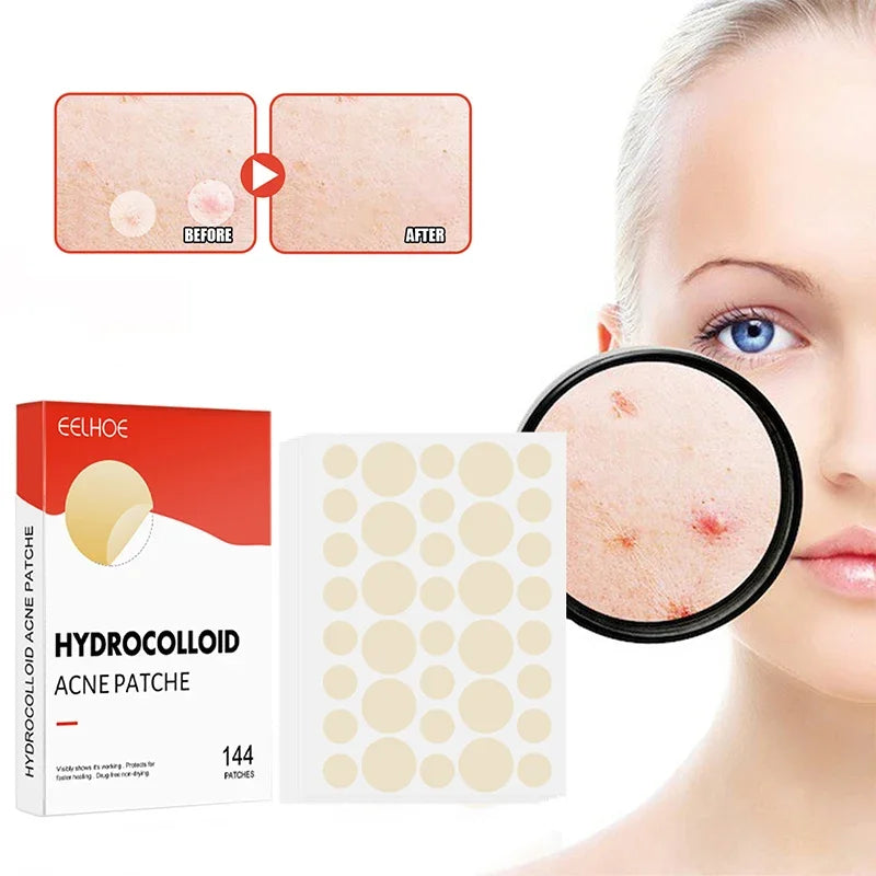 Clear Skin Magic Pimple Patches