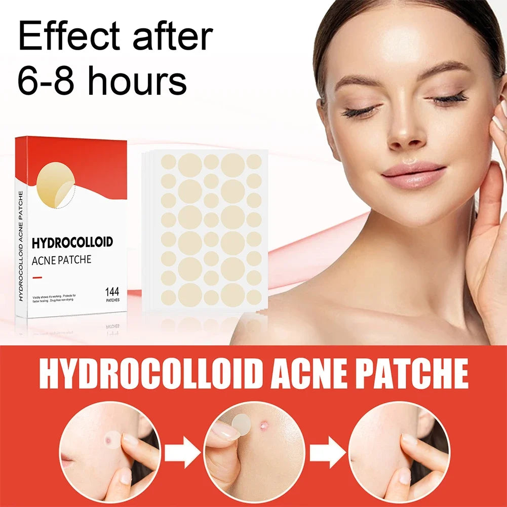 Clear Skin Magic Pimple Patches
