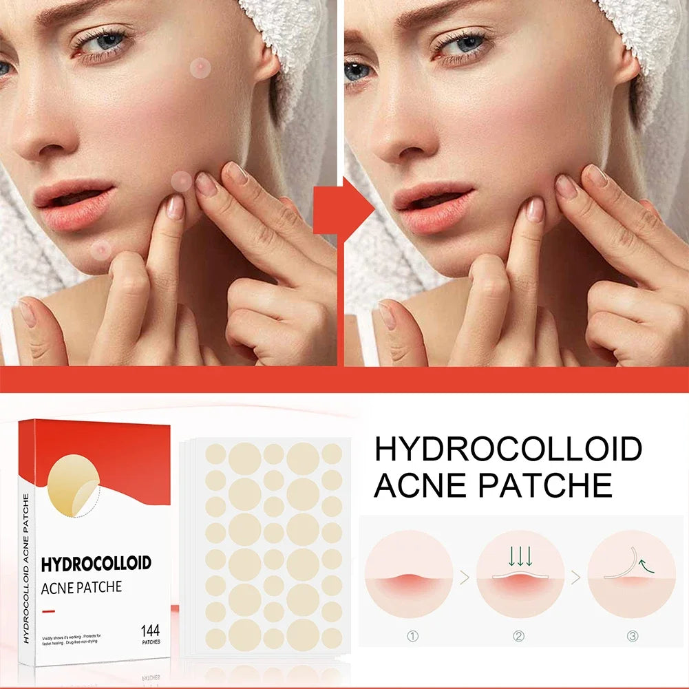 Clear Skin Magic Pimple Patches