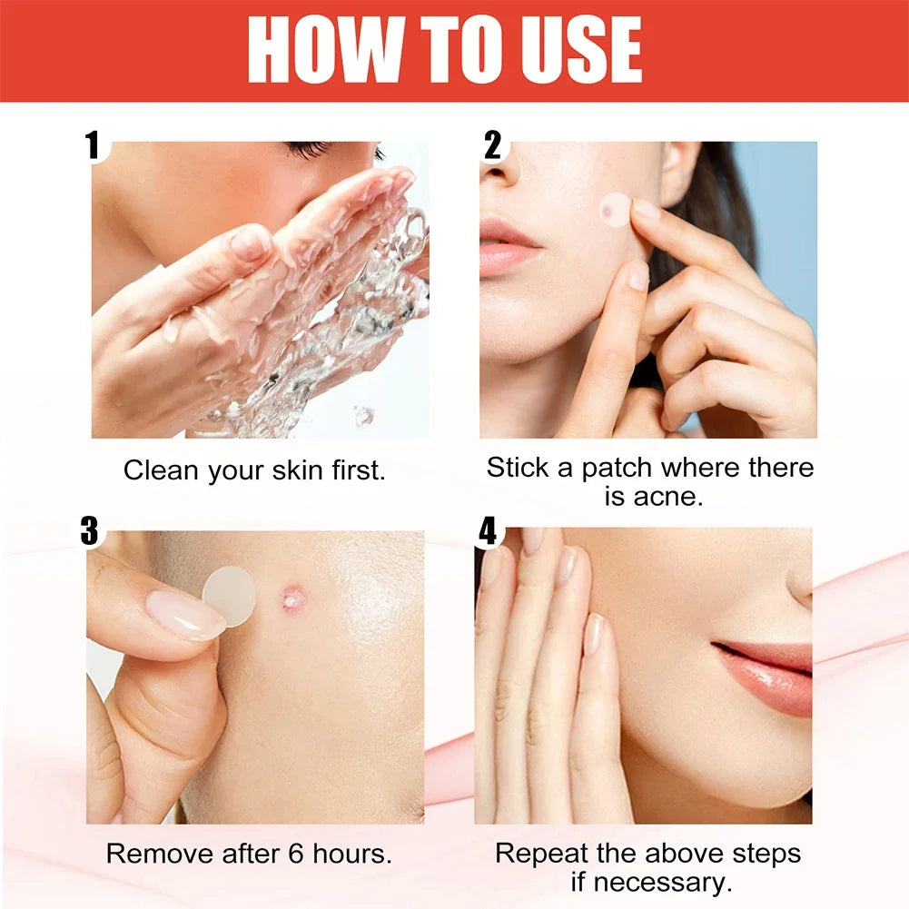 Clear Skin Magic Pimple Patches