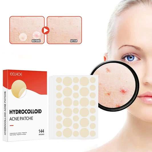 Clear Skin Magic Pimple Patches