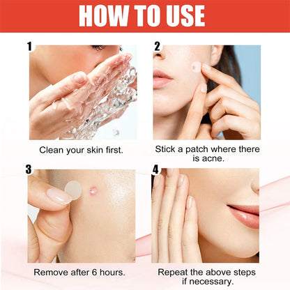 Clear Skin Magic Pimple Patches